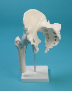 Gūžas locītava ar saitēm - mākslīgs modelis